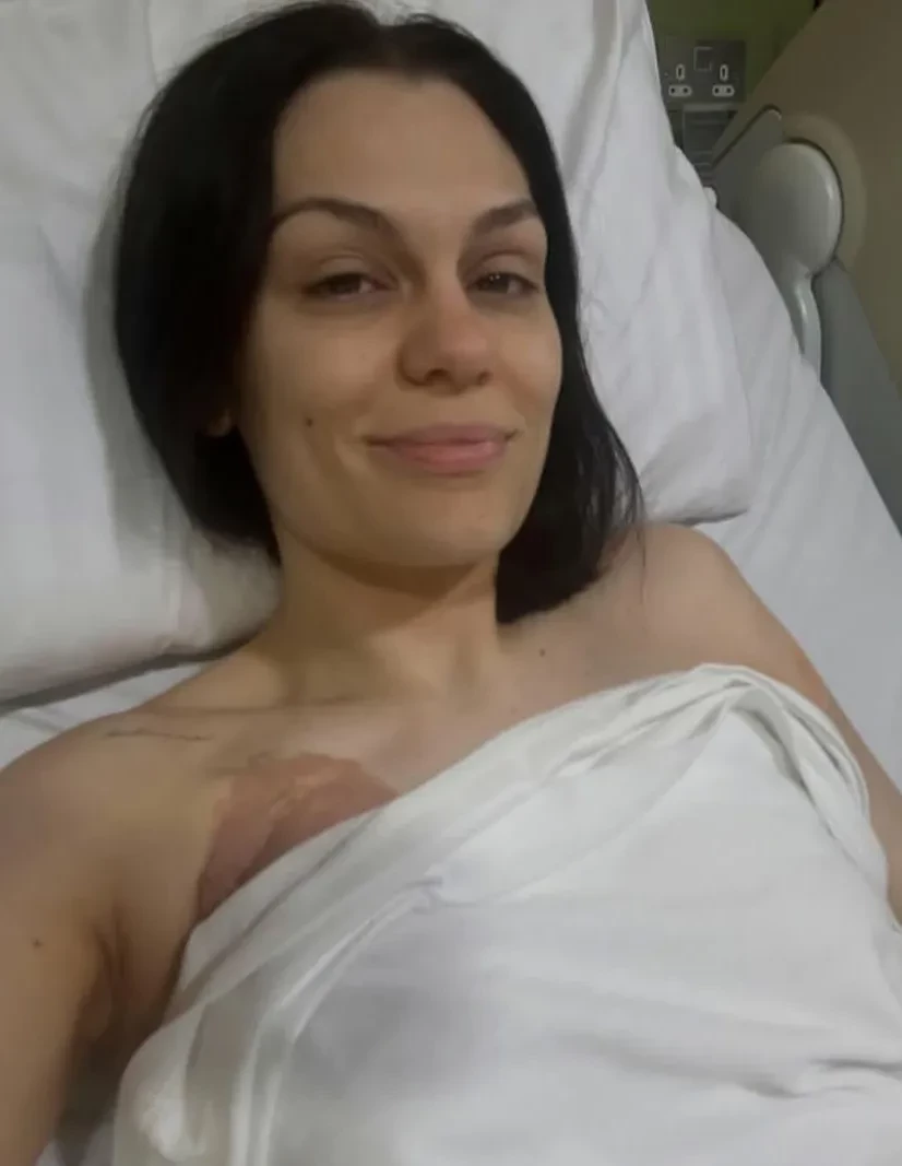 "Позволяю себе злиться". Джесси Джей, у которой обнаружили рак груди, рассказала о проведённой мастэктомии