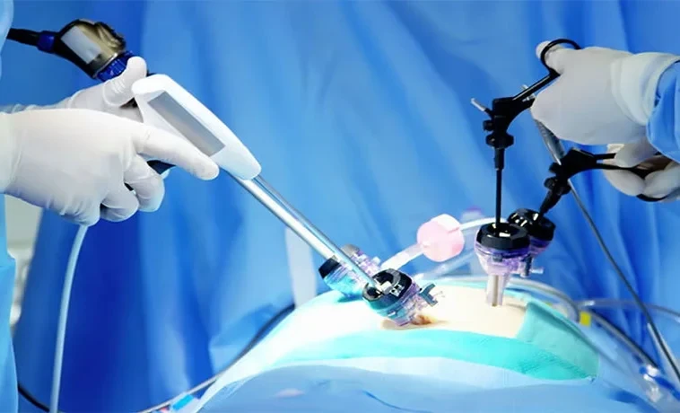 ЦОВП в Ат-Башинском районе передали лапароскоп с комплектацией на более $86 тыс.