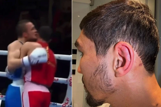 «Это не собачьи бои». Тренер Узбекистана — о том, как российский боксёр укусил узбекистанца в финале ЧМ