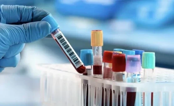 В Жогорку Кенеше подняли вопрос дорогих анализов в частных клиниках