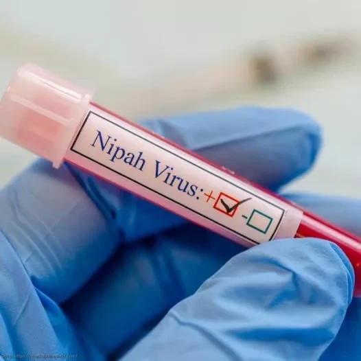 Минздрав Кыргызстана: На территории страны случаи заболевания вирусом Нипах не зарегистрированы